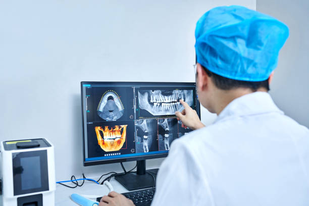 Best Emergency Wisdom Tooth Extraction in Newark, DE